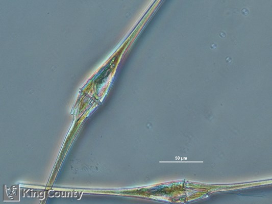 Photo of Ceratium fusus